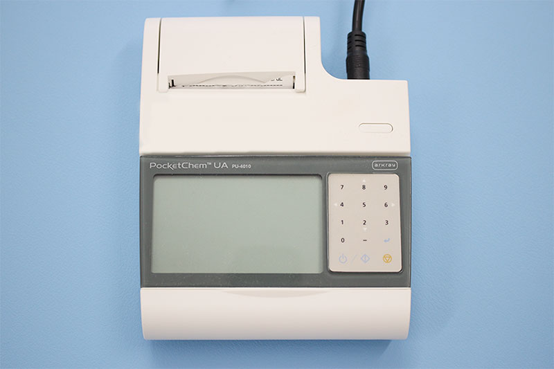 小型尿分析装置